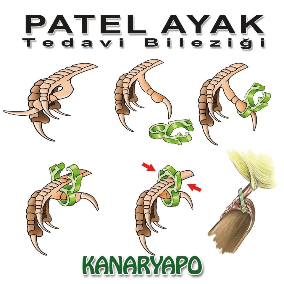 Kanaryapo Patel Ayak Tedavi Bileziği 8'li